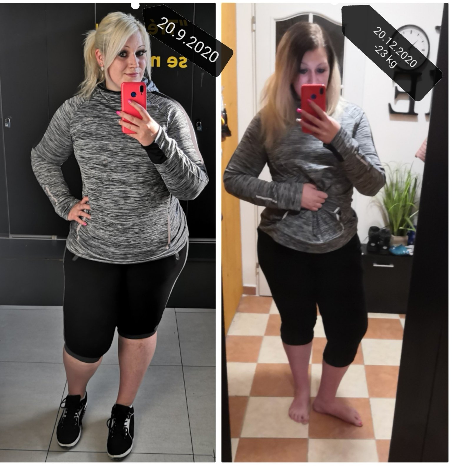 Příběh Jitky, které bandáž žaludku a abdominoplastika změnily život